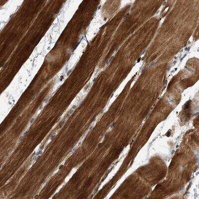 Immunohistochemistry-Paraffin: SOBP Antibody [NBP1-90442]