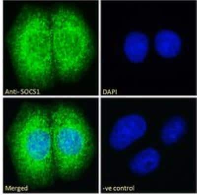 Immunocytochemistry/ Immunofluorescence: SOCS-1 Antibody [NB100-781]