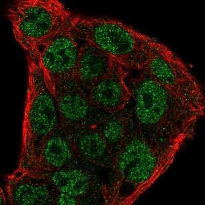 Immunocytochemistry/ Immunofluorescence: SOCS-1 Antibody [NBP2-56298]