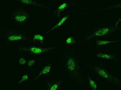 Immunocytochemistry/ Immunofluorescence: SOCS-1 Antibody [NBP2-98892]