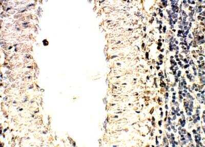 Immunohistochemistry-Paraffin: SOCS-1 Antibody [NBP3-12350]