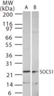 Western Blot: SOCS-1 Antibody [NB100-56637]