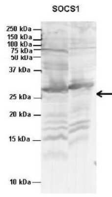 Western Blot: SOCS-1 Antibody [NBP1-58943]