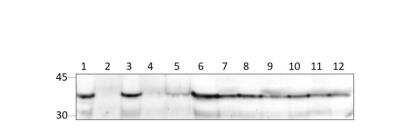 Western Blot: SOCS-1 Antibody [NBP3-12350]