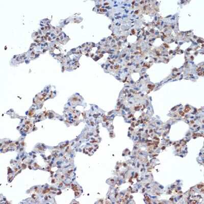 Immunohistochemistry-Paraffin: SOCS-2 Antibody (6D3F6) [NBP3-16781]