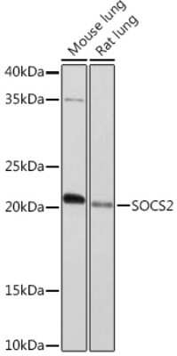 Western Blot: SOCS-2 Antibody (6D3F6) [NBP3-16781]