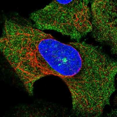 Immunocytochemistry/ Immunofluorescence: SOCS-3 Antibody [NBP2-57204]