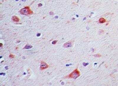 Immunohistochemistry-Paraffin: SOCS-3 Antibody [NBP2-27116]