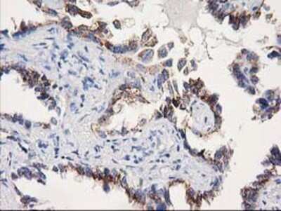 Immunohistochemistry: SOCS-3 Antibody (OTI3D3) - Azide and BSA Free [NBP2-74276]