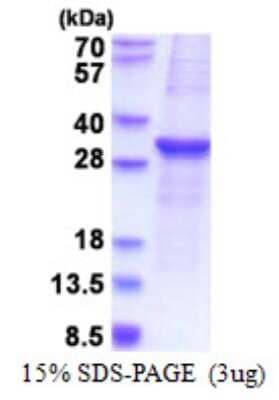 SDS-PAGE: Recombinant Human SOCS-3 His Protein [NBP2-51603]