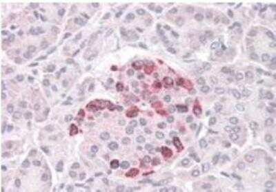 Immunohistochemistry-Paraffin: SOCS-4 Antibody [NB100-898]