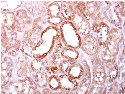 Immunohistochemistry-Paraffin: SOCS-4 Antibody [NBP1-31007]