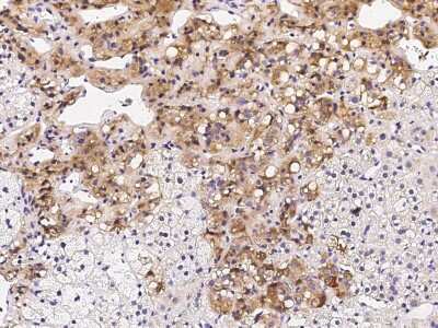 Immunohistochemistry-Paraffin: SOCS-4 Antibody [NBP2-98875]