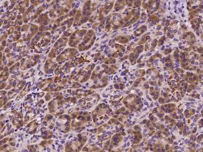Immunohistochemistry-Paraffin: SOCS-4 Antibody [NBP2-98875]