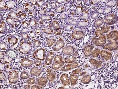 Immunohistochemistry-Paraffin: SOCS-4 Antibody [NBP2-98875]