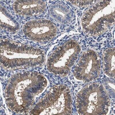 Immunohistochemistry-Paraffin: SOCS-5 Antibody [NBP1-85608]
