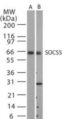 Western Blot: SOCS-5 Antibody [NB100-56639]