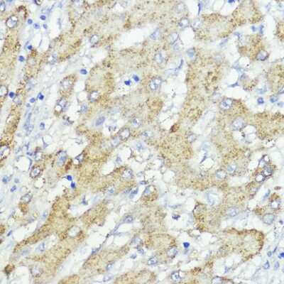 Immunohistochemistry-Paraffin: SOCS-6 Antibody - BSA Free [NBP2-94197]