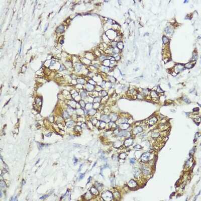 Immunohistochemistry-Paraffin: SOCS-6 Antibody - BSA Free [NBP2-94197]