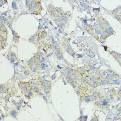 Immunohistochemistry-Paraffin: SOCS-6 Antibody - BSA Free [NBP2-94197]