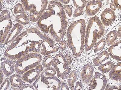 Immunohistochemistry-Paraffin: SOCS-6 Antibody [NBP2-98960]