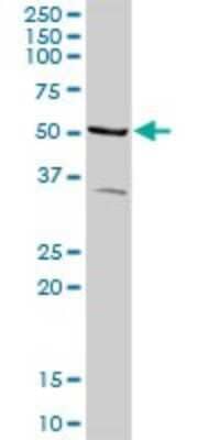 Western Blot: SOCS-6 Antibody [H00009306-D01P]