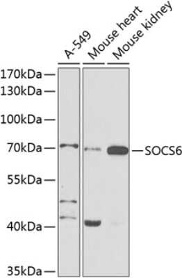 Western Blot: SOCS-6 AntibodyBSA Free [NBP2-94197]