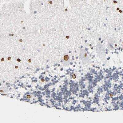Immunohistochemistry-Paraffin: SOCS-7/Nck/NAP4 Antibody [NBP2-13363]