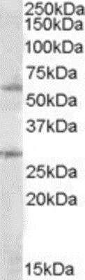 Western Blot: SOCS-7/Nck/NAP4 Antibody [NBP1-06994]