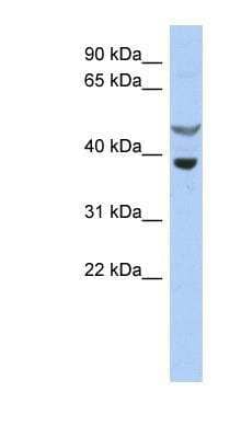 Western Blot: SOCS-7/Nck/NAP4 Antibody [NBP1-58902]