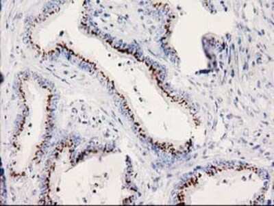 Immunohistochemistry-Paraffin: SOCS-3 Antibody (OTI3D3) [NBP2-00817]
