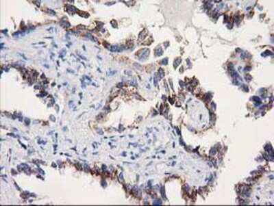 Immunohistochemistry-Paraffin: SOCS-3 Antibody (OTI3D3) [NBP2-00817]