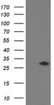 Western Blot: SOCS-3 Antibody (OTI3D3) [NBP2-00817]