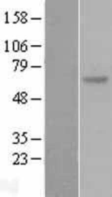 Western Blot: SOCS-5 Overexpression Lysate [NBL1-16329]