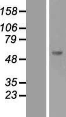 Western Blot: SOCS-5 Overexpression Lysate [NBL1-16330]