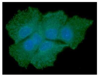 Immunocytochemistry/ Immunofluorescence: SOD1/Cu-Zn SOD Antibody (6F1) - BSA Free [NBP2-59422]