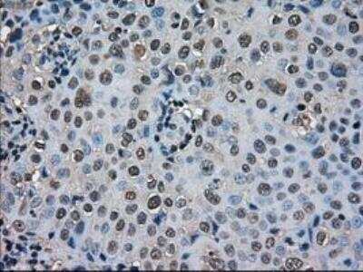 Immunohistochemistry-Paraffin: SOD1/Cu-Zn SOD Antibody (OTI8B10) [NBP1-47993]