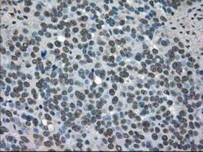 Immunohistochemistry-Paraffin: SOD1/Cu-Zn SOD Antibody (OTI8B10) [NBP1-47993]