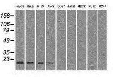 Western Blot: SOD1/Cu-Zn SOD Antibody (OTI8B10) [NBP1-47993]