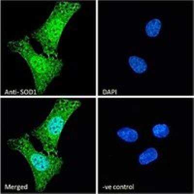 Immunocytochemistry/ Immunofluorescence: SOD1/Cu-Zn SOD Antibody [NB100-60944]