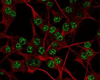Immunocytochemistry/ Immunofluorescence: SOD1/Cu-Zn SOD Antibody [NBP2-20534]