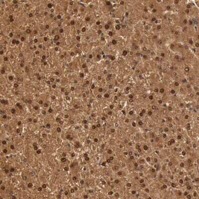 Immunohistochemistry-Paraffin: SOD1/Cu-Zn SOD Antibody [NBP1-90186]