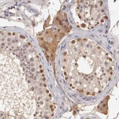 Immunohistochemistry-Paraffin: SOD1/Cu-Zn SOD Antibody [NBP1-90186]