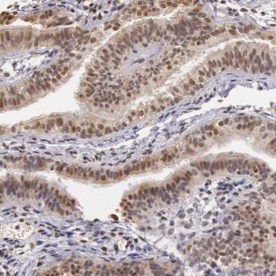 Immunohistochemistry-Paraffin: SOD1/Cu-Zn SOD Antibody [NBP1-90186]