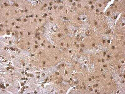 Immunohistochemistry-Paraffin: SOD1/Cu-Zn SOD Antibody [NBP2-20534]