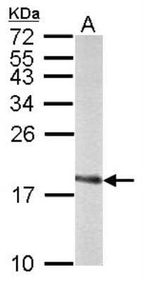 Western Blot: SOD1/Cu-Zn SOD Antibody [NBP1-31204]