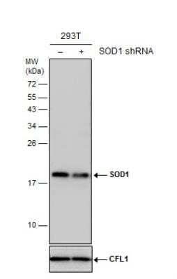 Knockout Validated: SOD1/Cu-Zn SOD Antibody [NBP1-31204]