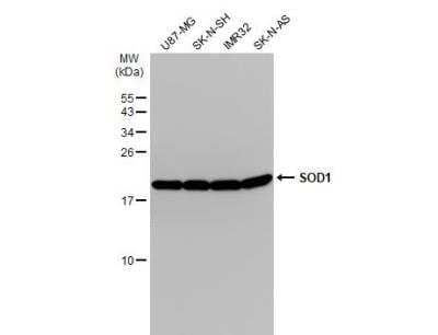 Western Blot: SOD1/Cu-Zn SOD Antibody [NBP1-31204]