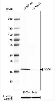 Western Blot: SOD1/Cu-Zn SOD Antibody [NBP1-90186]