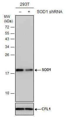Western Blot: SOD1/Cu-Zn SOD Antibody [NBP2-20534]